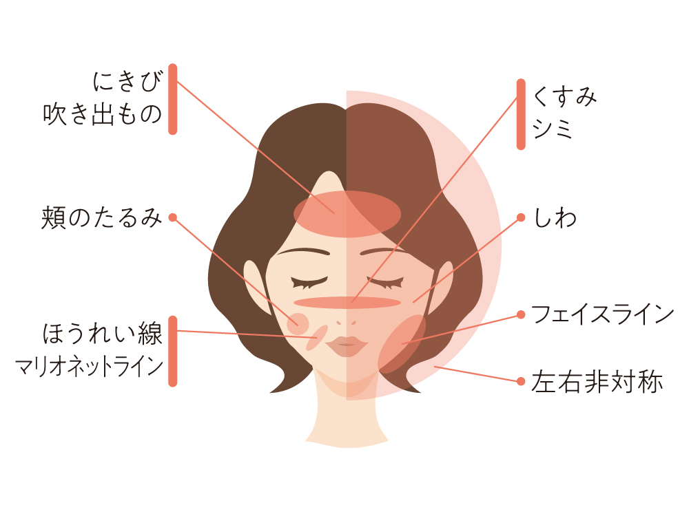 顔のお悩み