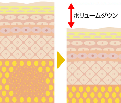 脂肪分解が開始され10日～14日後に変化が出てきます